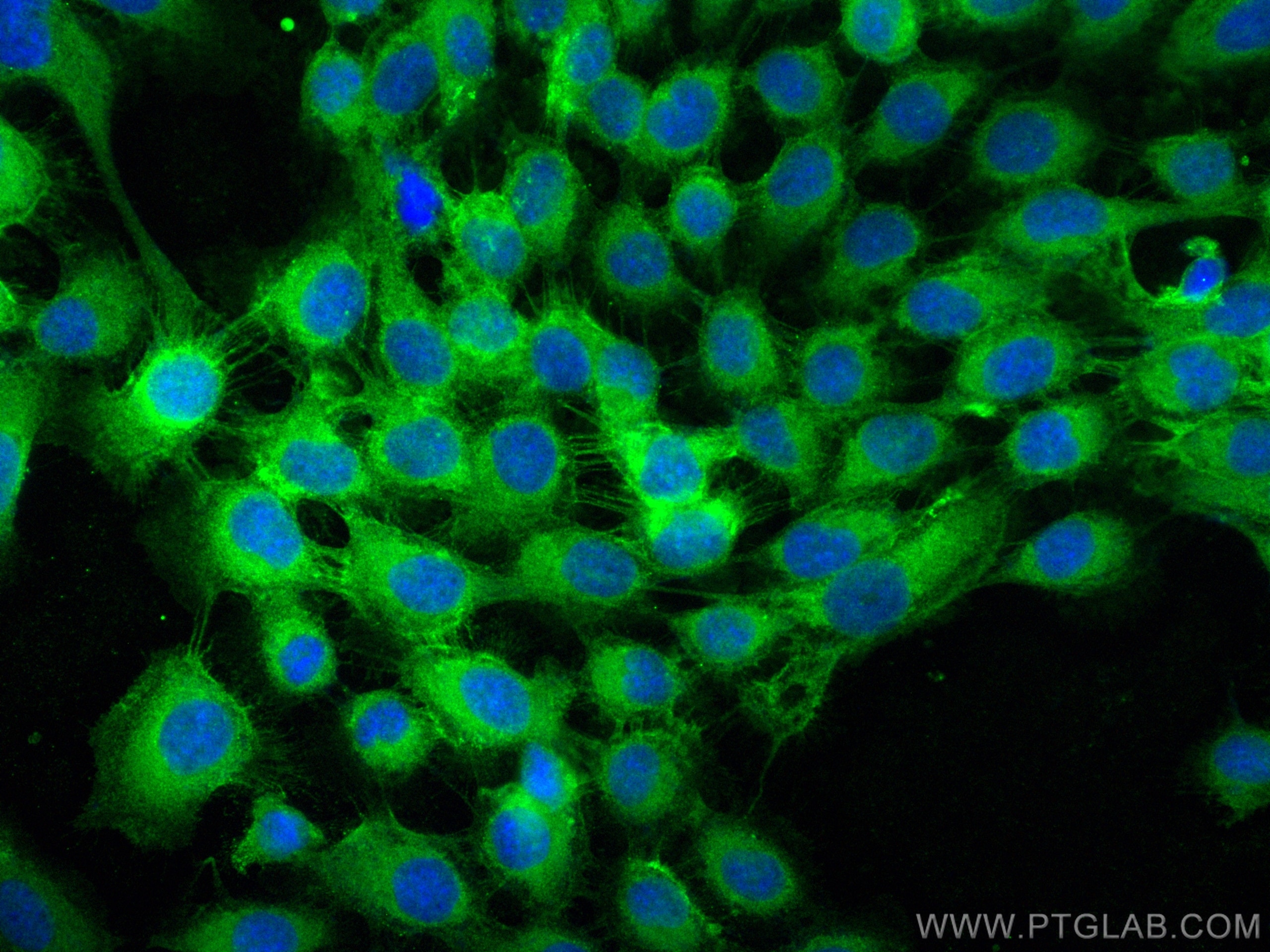 Immunofluorescence (IF) / fluorescent staining of A431 cells using CoraLite® Plus 488-conjugated Integrin Beta 4 Poly (CL488-21738)