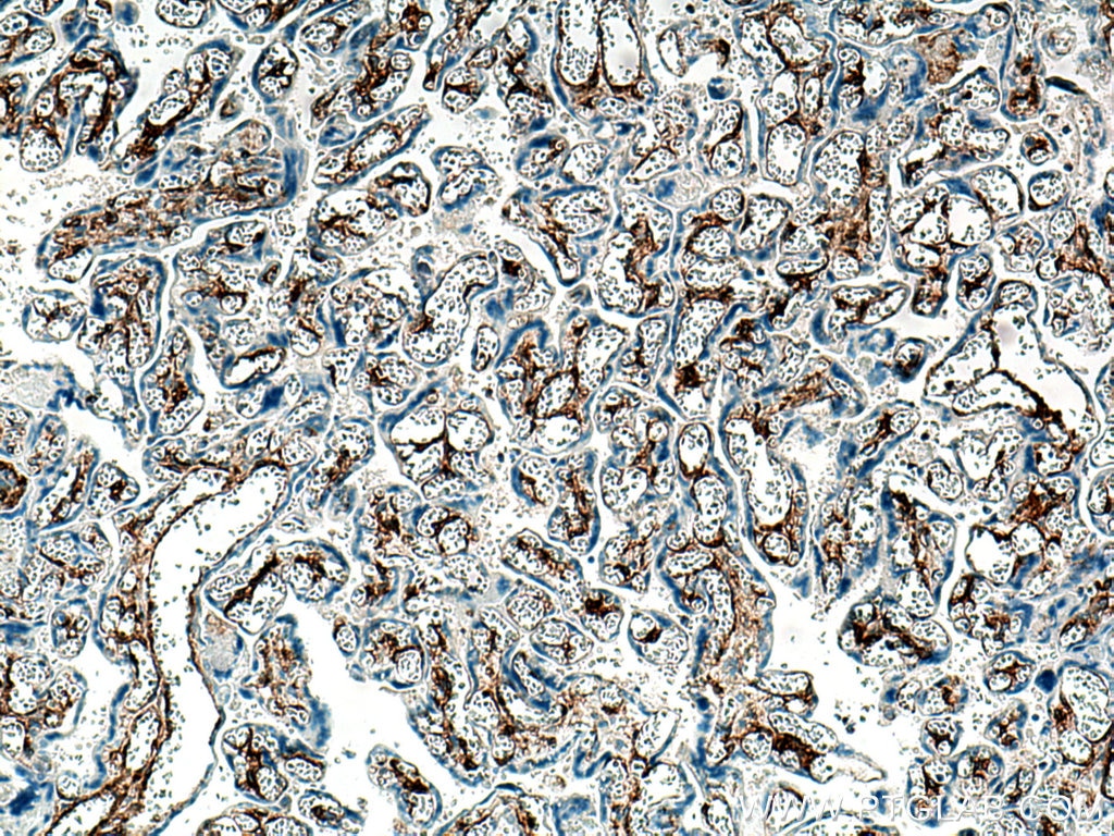 Immunohistochemistry (IHC) staining of human placenta tissue using Integrin alpha-1 Polyclonal antibody (29042-1-AP)