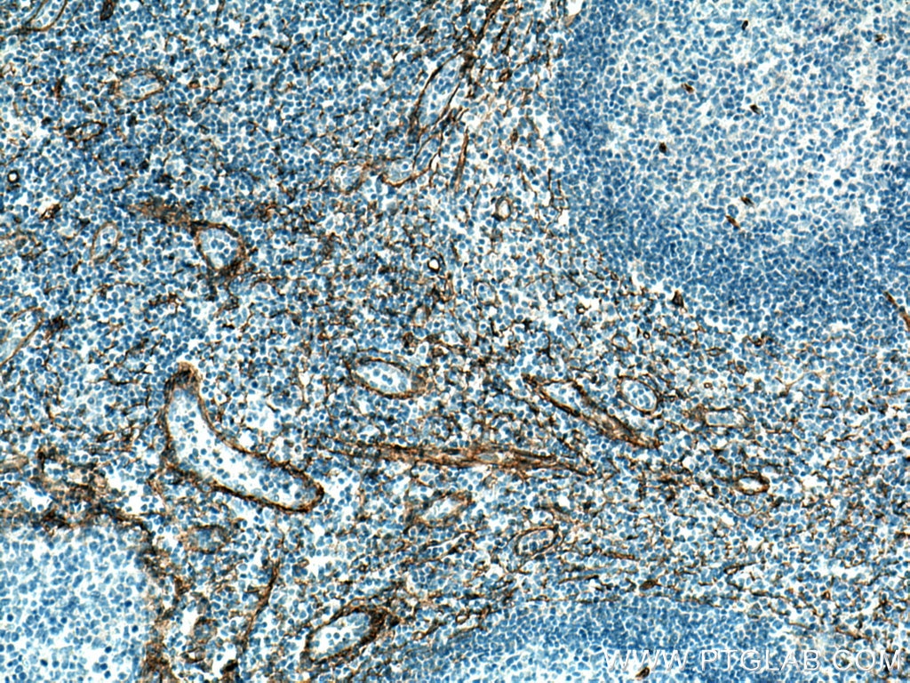 Immunohistochemistry (IHC) staining of human tonsillitis tissue using Integrin alpha-1 Polyclonal antibody (29042-1-AP)