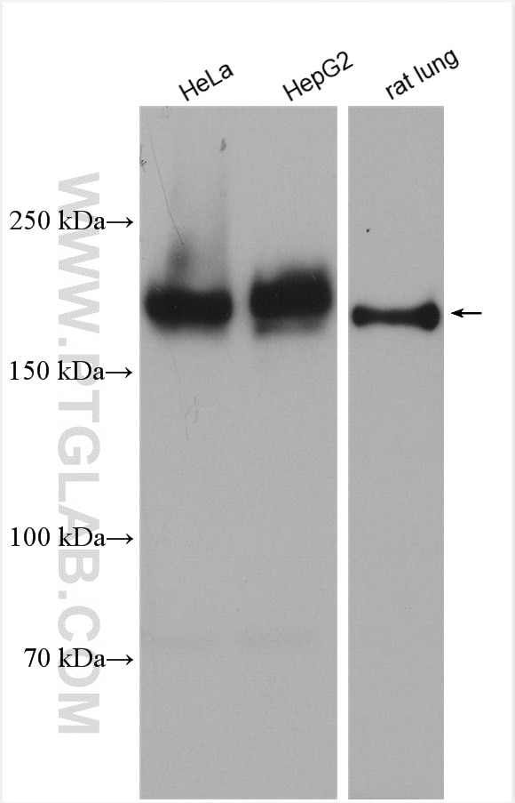 Western Blot (WB) analysis of various lysates using Integrin alpha-1 Polyclonal antibody (29042-1-AP)