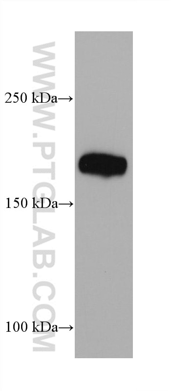 Western Blot (WB) analysis of human placenta tissue using Integrin alpha-1 Monoclonal antibody (68211-1-Ig)