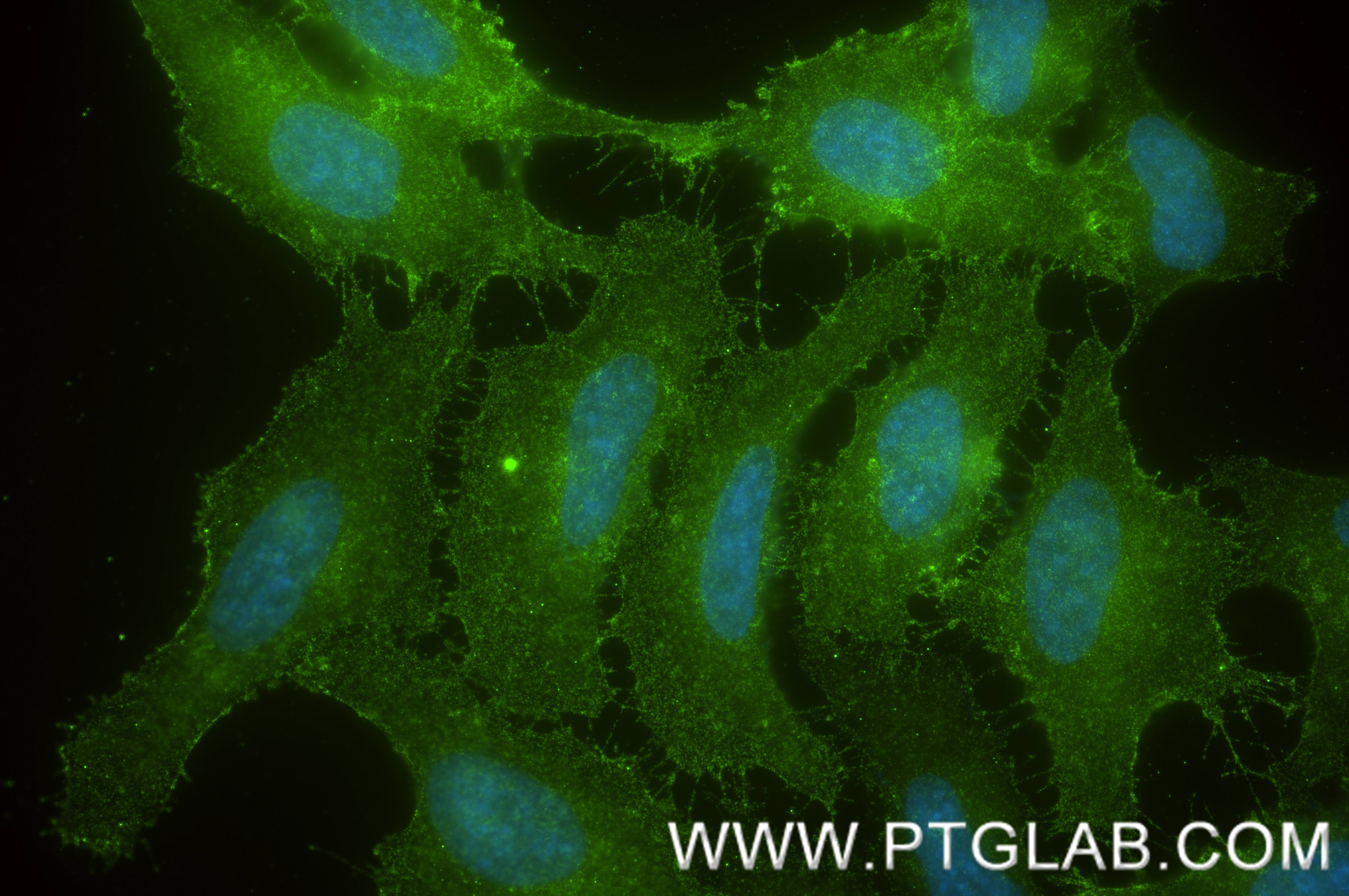 Immunofluorescence (IF) / fluorescent staining of HeLa cells using Integrin alpha 1 Recombinant monoclonal antibody (87056-2-RR)