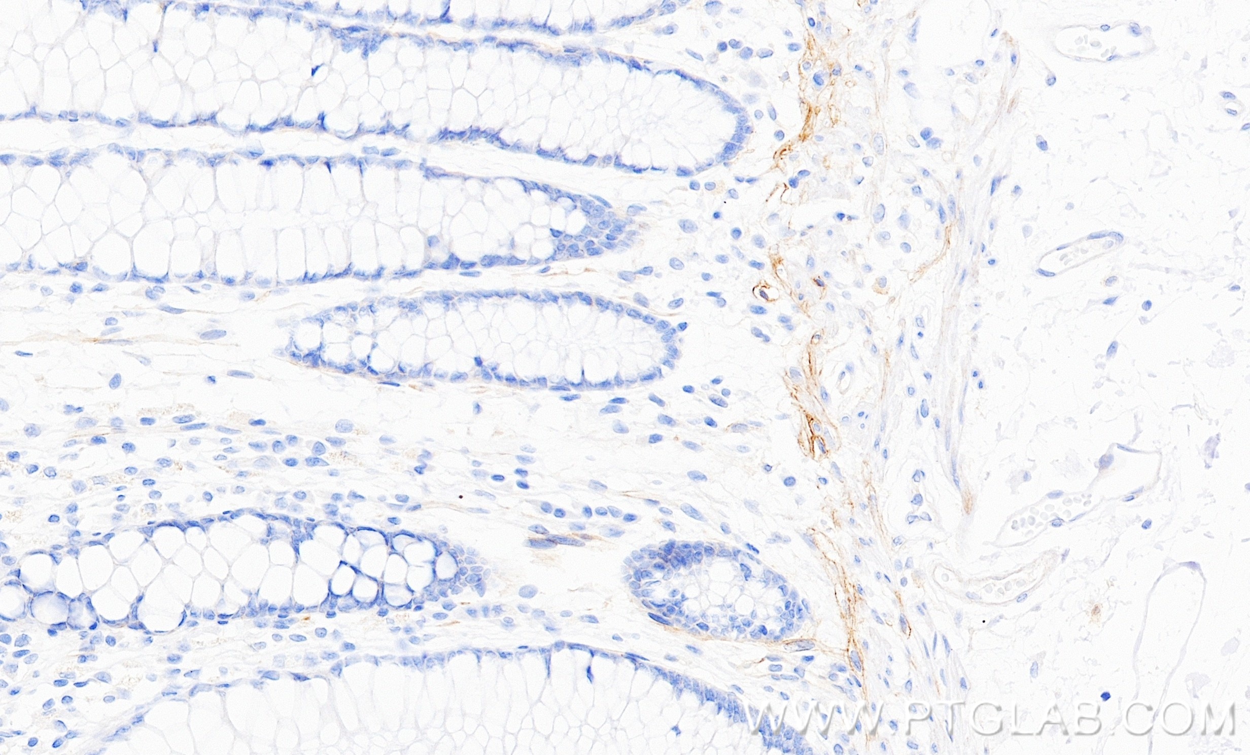 IHC staining of human large intestine using 87056-2-RR (same clone as 87056-2-PBS) Immunohistochemistry (IHC) staining of human large intestine tissue using Integrin alpha 1/CD49a Recombinant monoclonal anti (87056-2-RR)