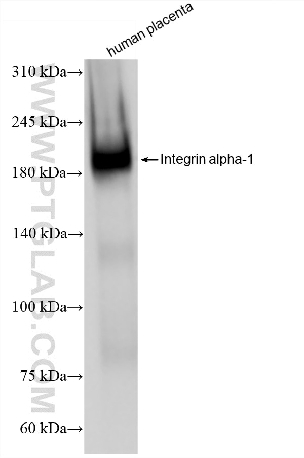 Western Blot (WB) analysis of human placenta tissue using Integrin alpha 1 Recombinant monoclonal antibody (87056-2-RR)
