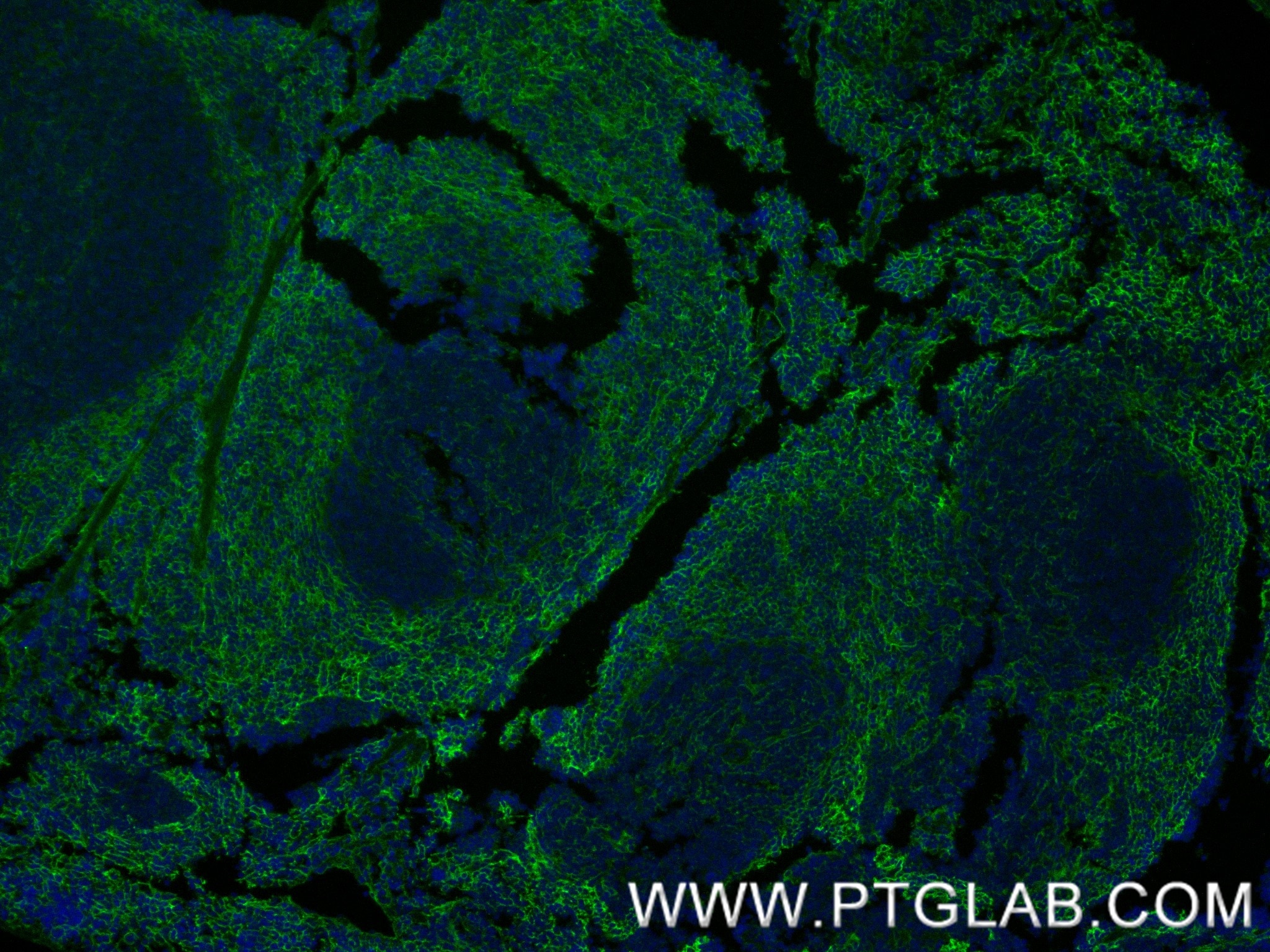 Immunofluorescence (IF) / fluorescent staining of mouse spleen tissue using Integrin alpha 1/CD49a Recombinant monoclonal anti (87056-3-RR)