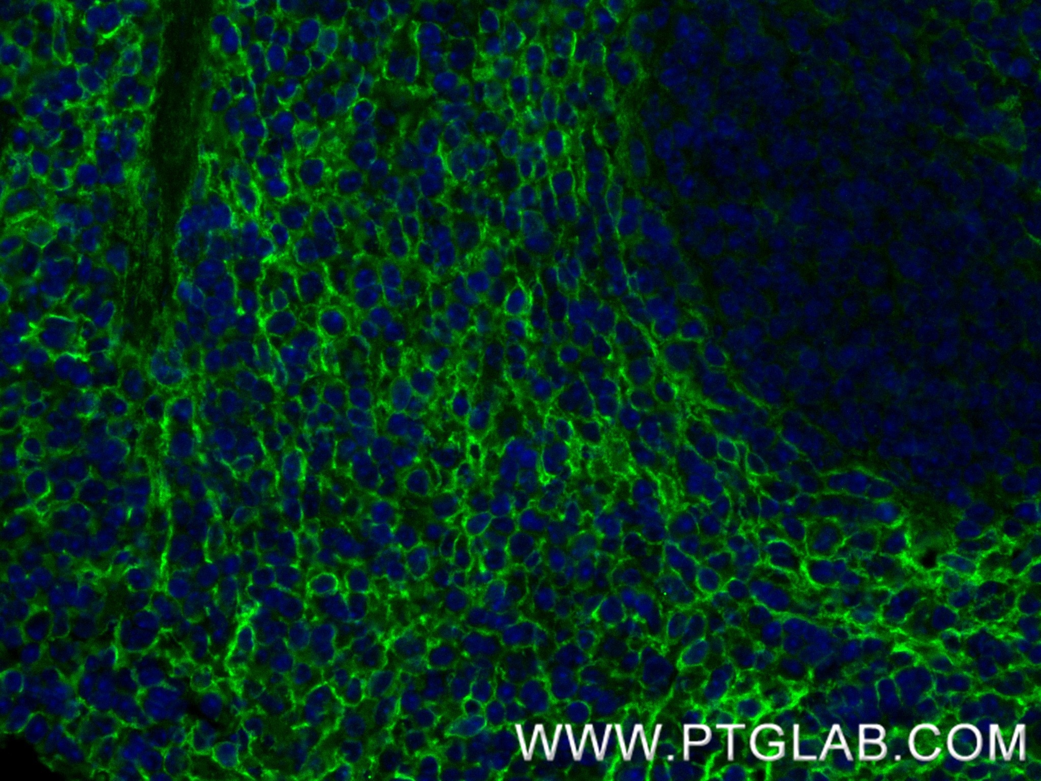 Immunofluorescence (IF) / fluorescent staining of mouse spleen tissue using Integrin alpha 1/CD49a Recombinant monoclonal anti (87056-3-RR)