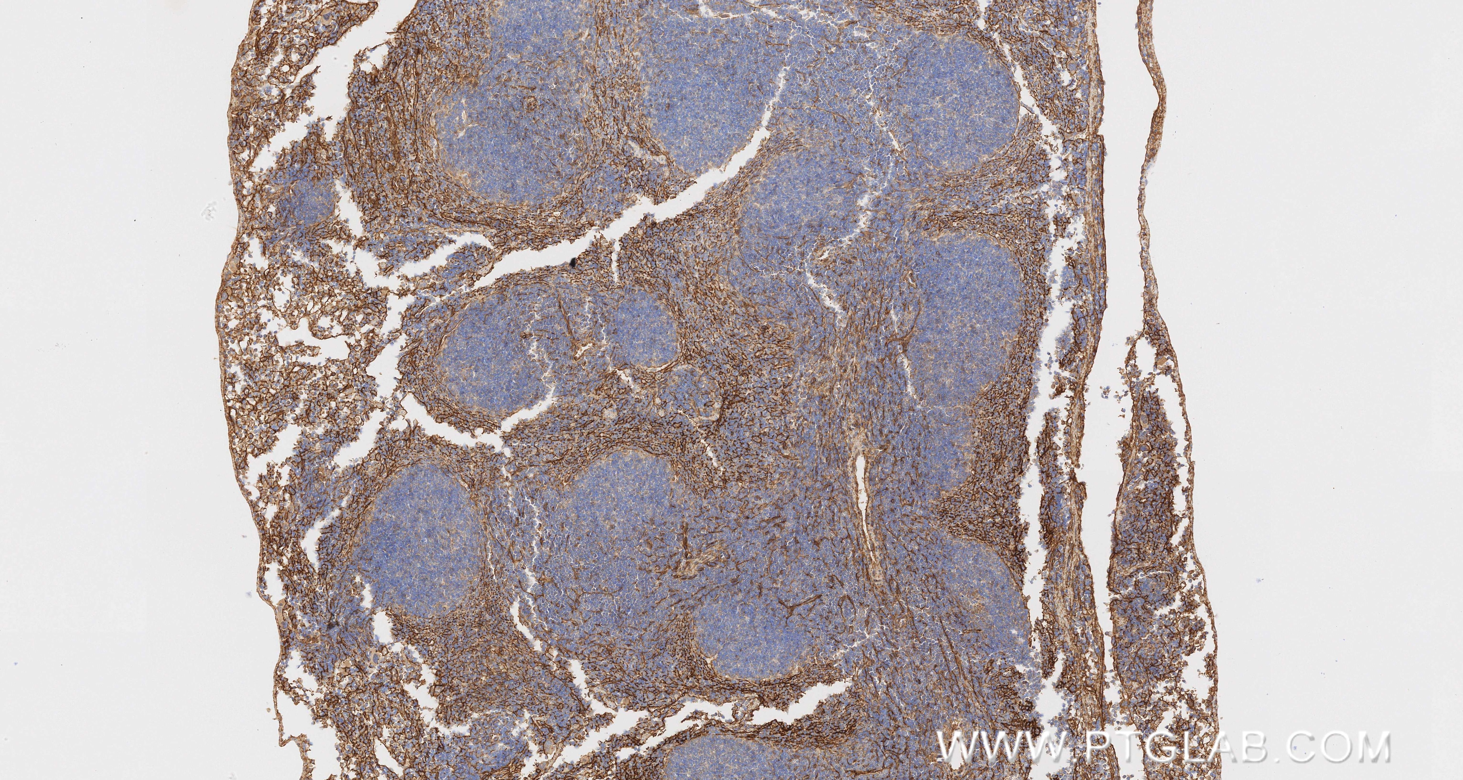 Immunohistochemistry (IHC) staining of mouse spleen tissue using Integrin alpha 1/CD49a Recombinant monoclonal anti (87056-3-RR)
