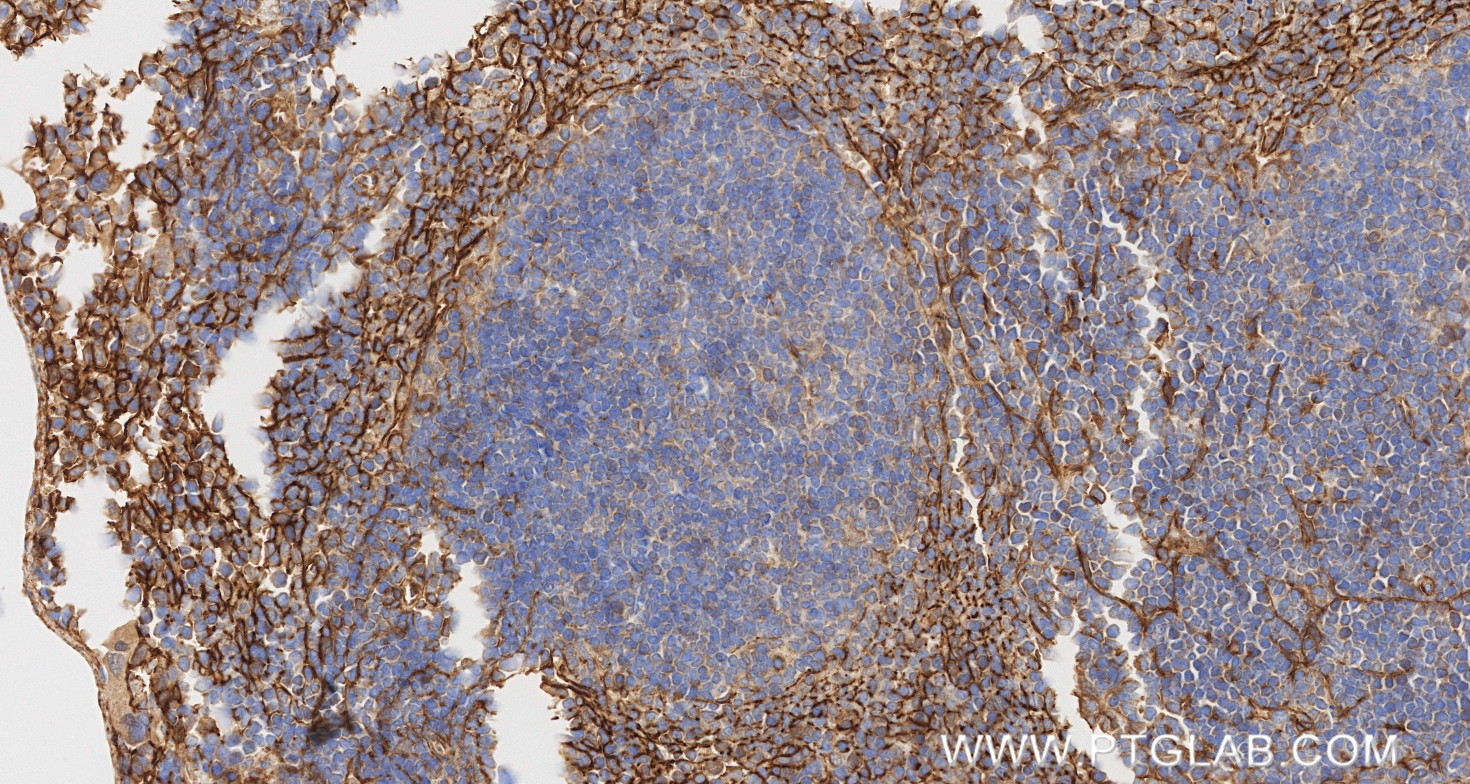 Immunohistochemistry (IHC) staining of mouse spleen tissue using Integrin alpha 1/CD49a Recombinant monoclonal anti (87056-3-RR)