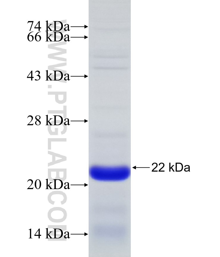 Integrin alpha-1 fusion protein Ag30631 SDS-PAGE
