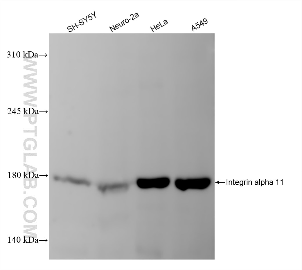Western Blot (WB) analysis of various lysates using Integrin alpha 11 Recombinant antibody (84695-1-RR)
