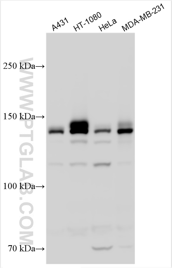 Western Blot (WB) analysis of various lysates using Integrin alpha 2 Polyclonal antibody (30703-1-AP)