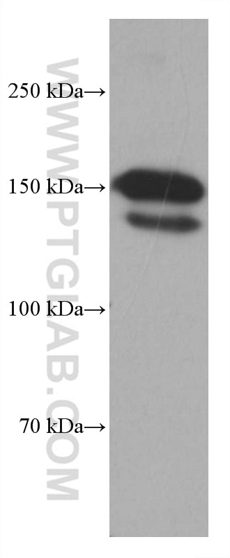 Integrin Alpha 4