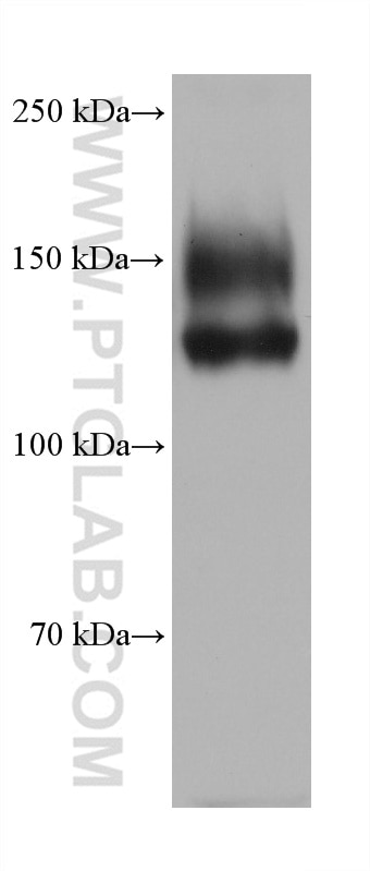 Western Blot (WB) analysis of NK-92 cells using Integrin Alpha 4 Monoclonal antibody (67040-1-Ig)