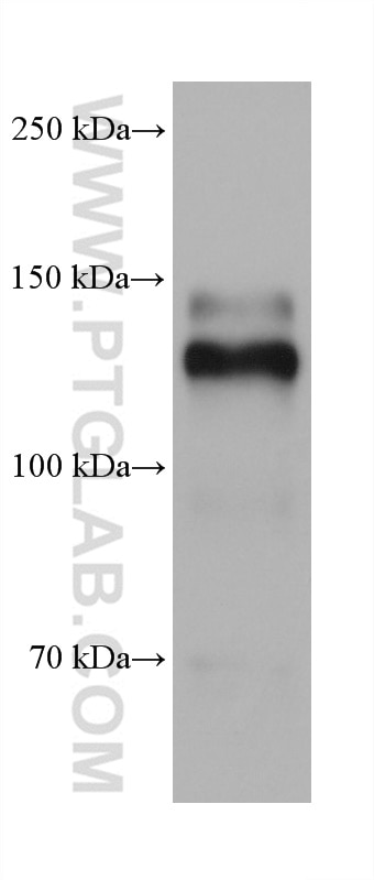 Western Blot (WB) analysis of U-937 cells using Integrin Alpha 4 Monoclonal antibody (67040-1-Ig)