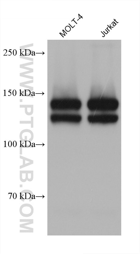 Western Blot (WB) analysis of various lysates using Integrin Alpha 4 Monoclonal antibody (67040-1-Ig)