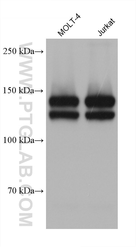 WB analysis using 67040-1-Ig