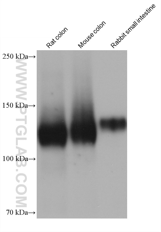 Western Blot (WB) analysis of various lysates using Integrin alpha-5 Monoclonal antibody (68561-1-Ig)