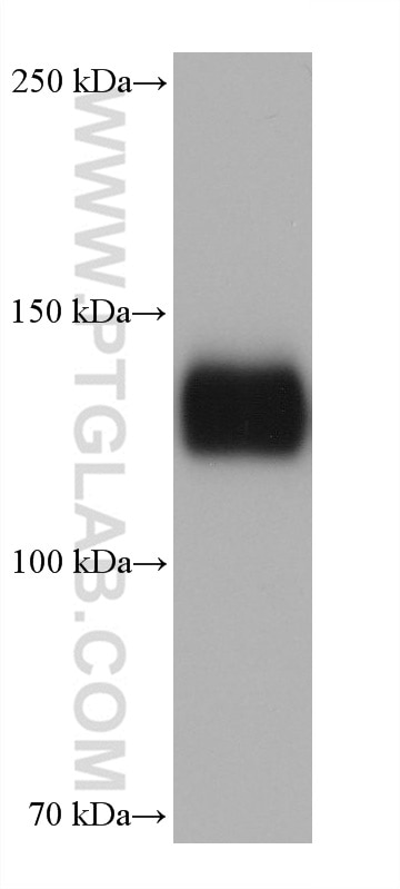 Western Blot (WB) analysis of K-562 cells using Integrin alpha-5 Monoclonal antibody (68561-1-Ig)