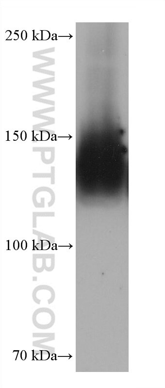 Western Blot (WB) analysis of Jurkat cells using Integrin alpha-5 Monoclonal antibody (68561-1-Ig)