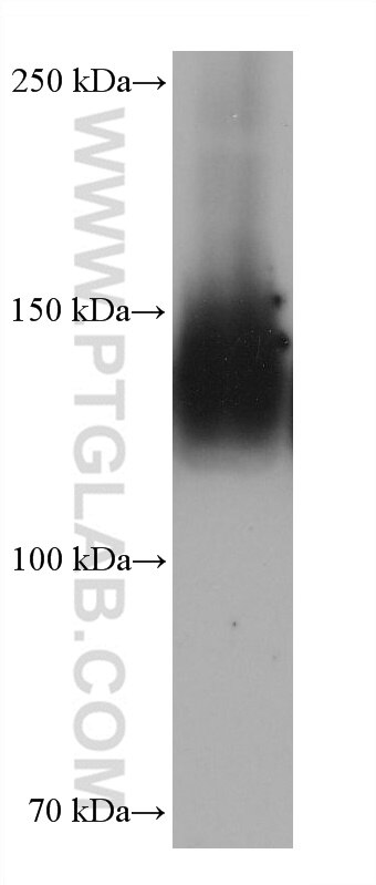 WB analysis of Jurkat using 68561-1-Ig