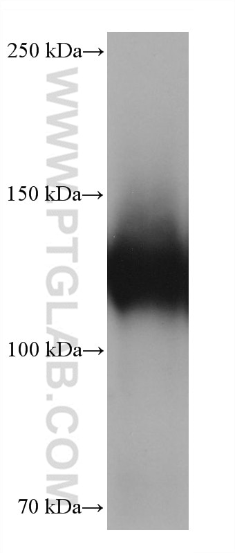 Western Blot (WB) analysis of pig colon tissue using Integrin alpha-5 Monoclonal antibody (68561-1-Ig)