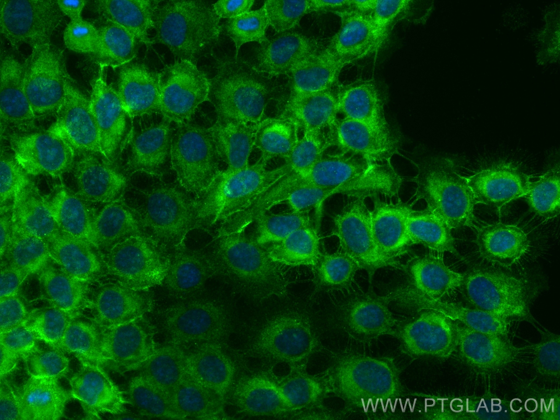 Immunofluorescence (IF) / fluorescent staining of A431 cells using Integrin alpha 6 Polyclonal antibody (27189-1-AP)