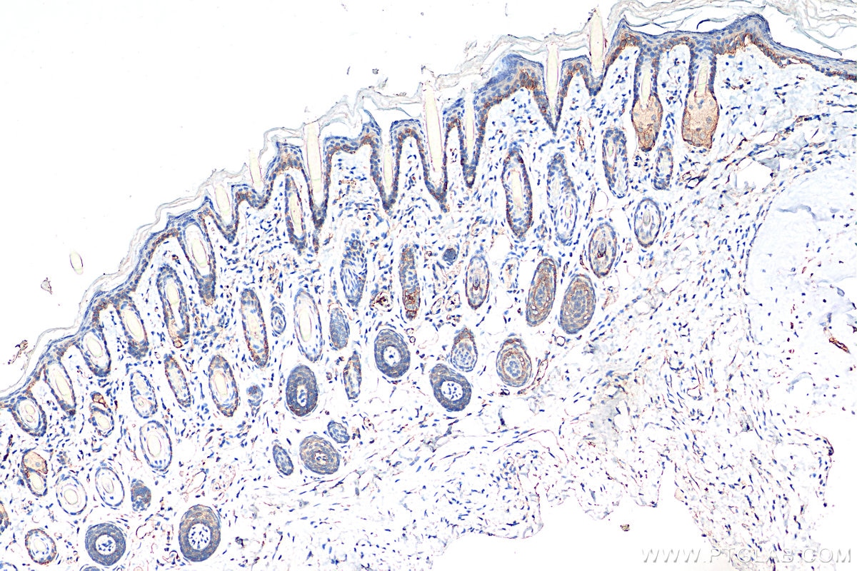 Immunohistochemistry (IHC) staining of mouse skin tissue using Integrin Alpha 6 Polyclonal antibody (27189-1-AP)