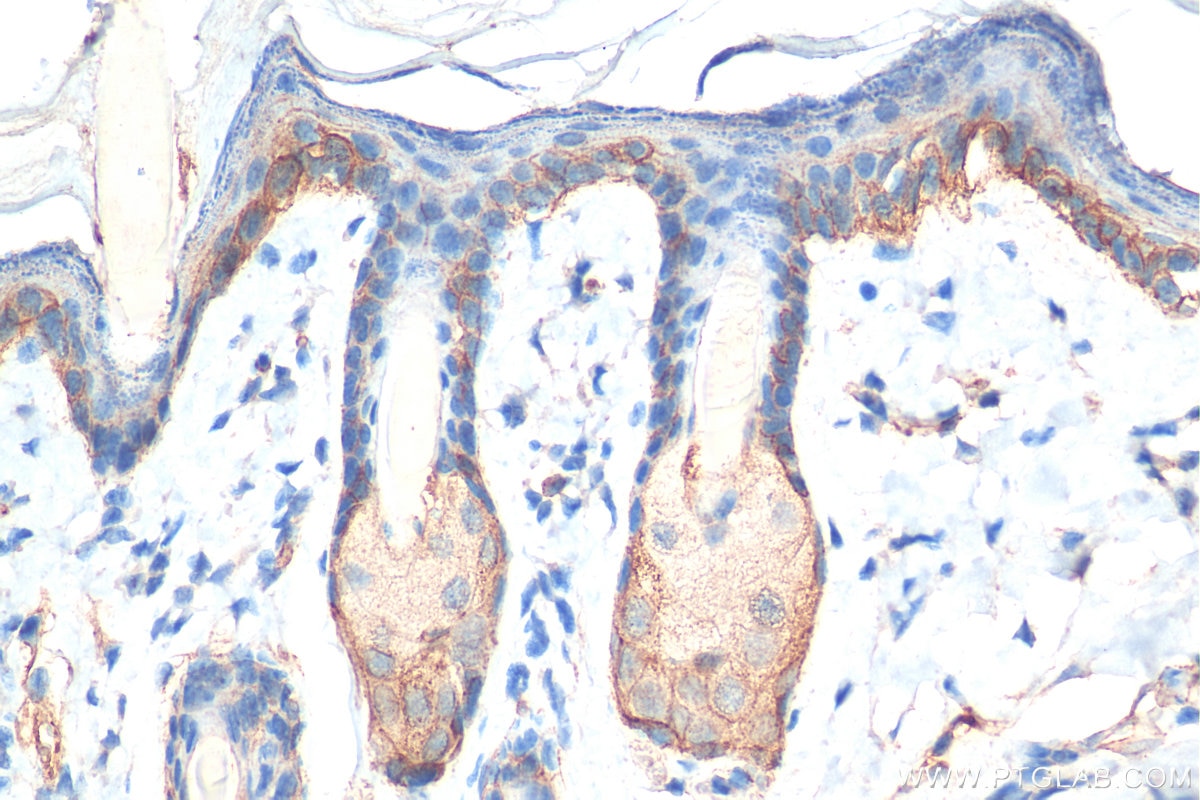 Immunohistochemistry (IHC) staining of mouse skin tissue using Integrin Alpha 6 Polyclonal antibody (27189-1-AP)