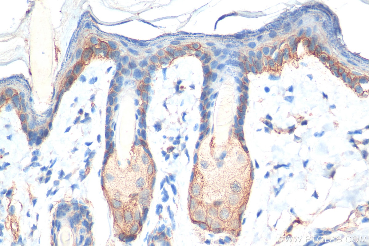 IHC staining of mouse skin using 27189-1-AP