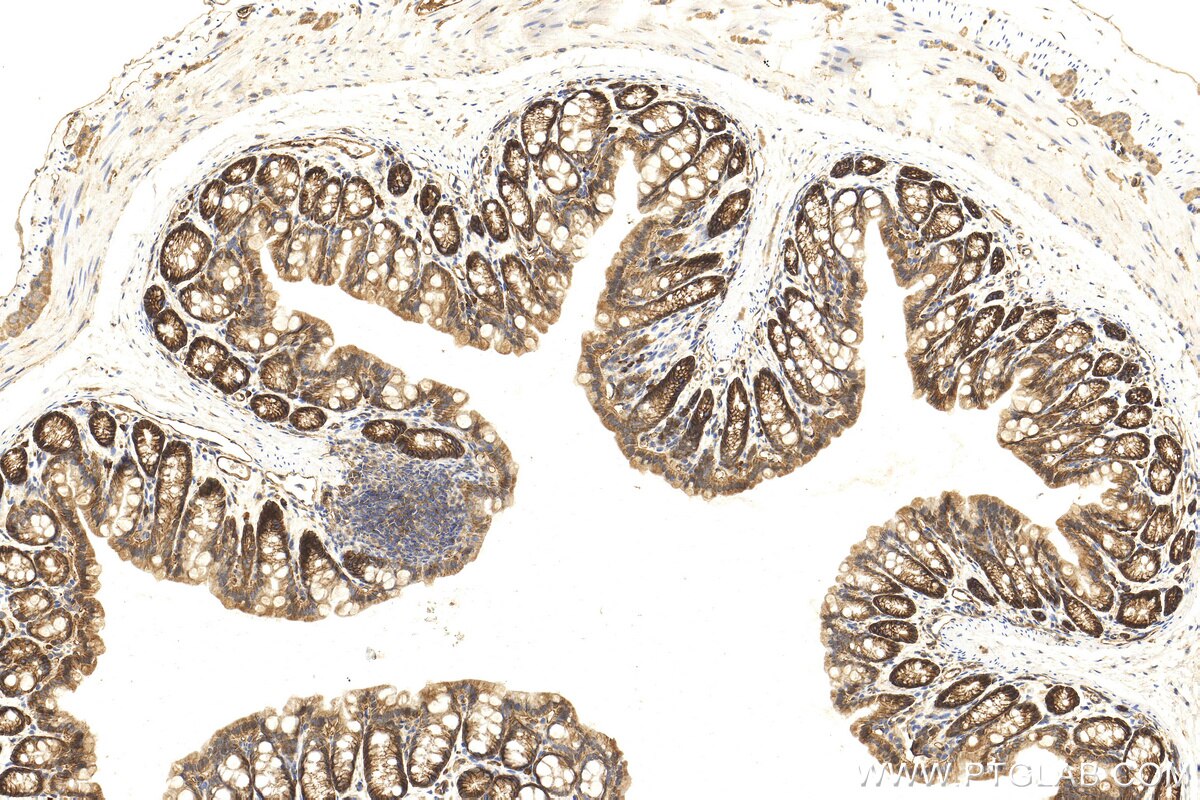 Immunohistochemistry (IHC) staining of mouse colon tissue using Integrin alpha 6 Polyclonal antibody (27189-1-AP)