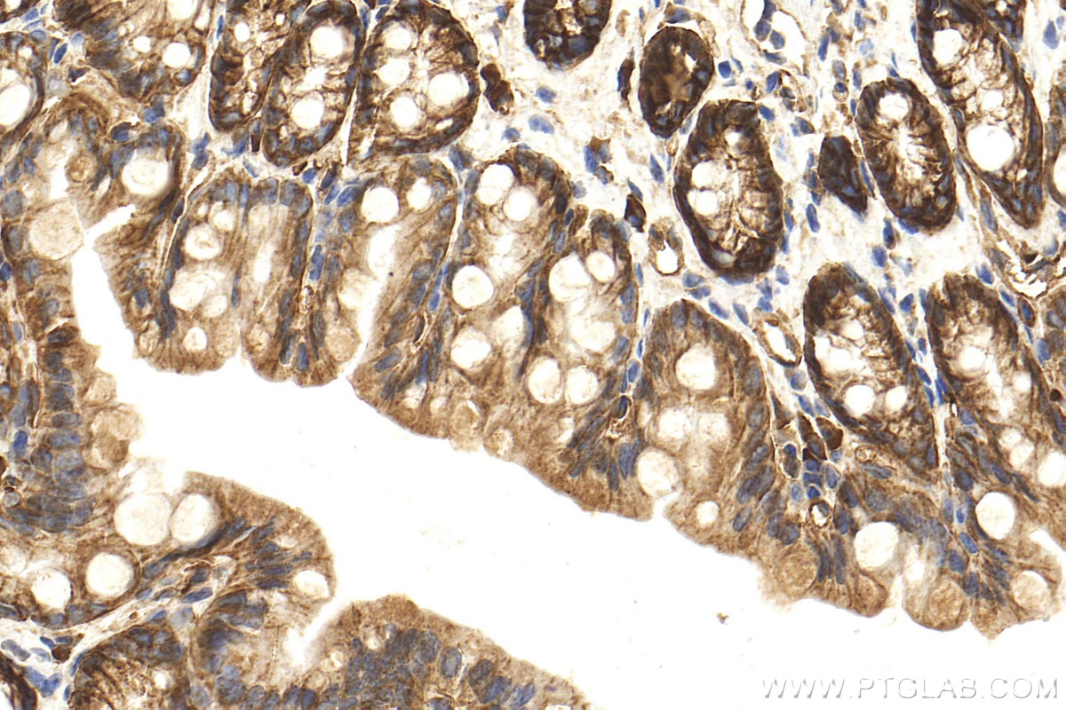 Immunohistochemistry (IHC) staining of mouse colon tissue using Integrin alpha 6 Polyclonal antibody (27189-1-AP)