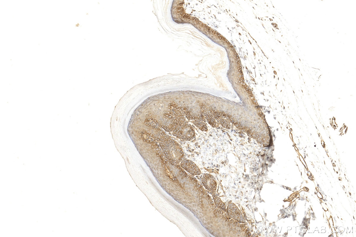 Immunohistochemistry (IHC) staining of mouse skin tissue using Integrin alpha 6 Polyclonal antibody (27189-1-AP)