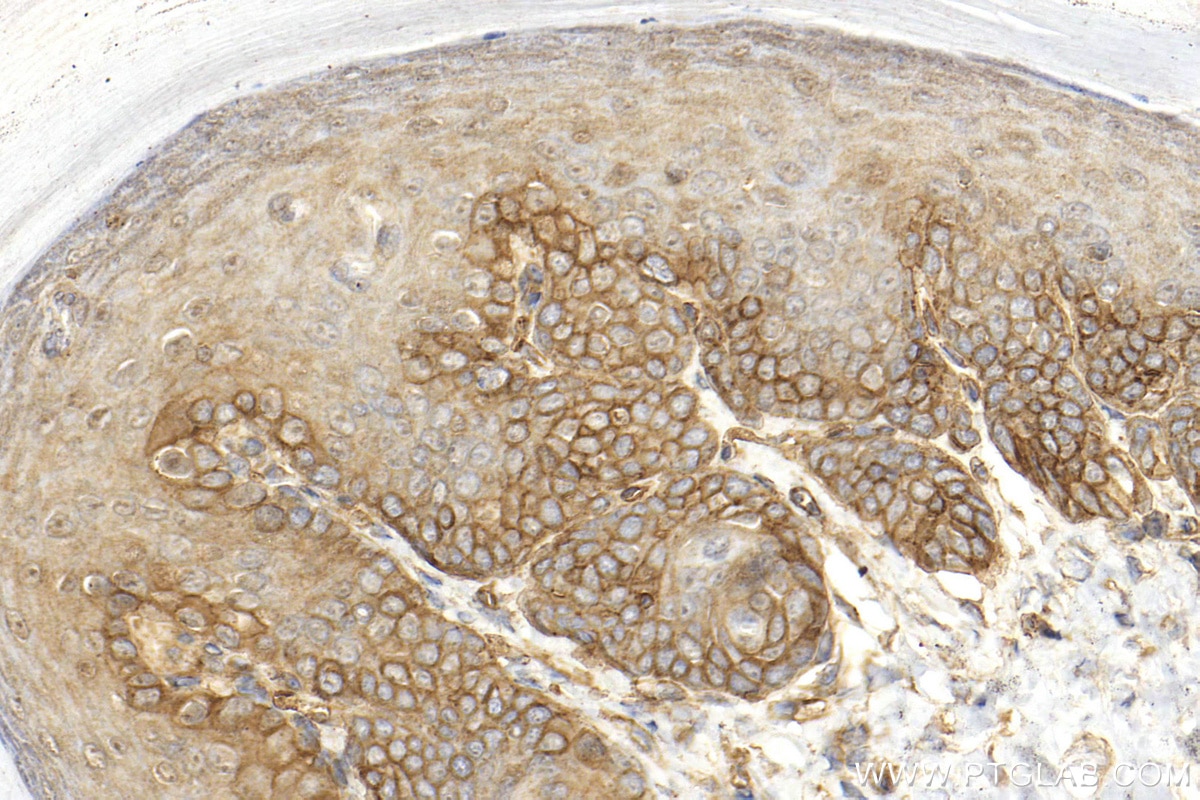 Immunohistochemistry (IHC) staining of mouse skin tissue using Integrin alpha 6 Polyclonal antibody (27189-1-AP)