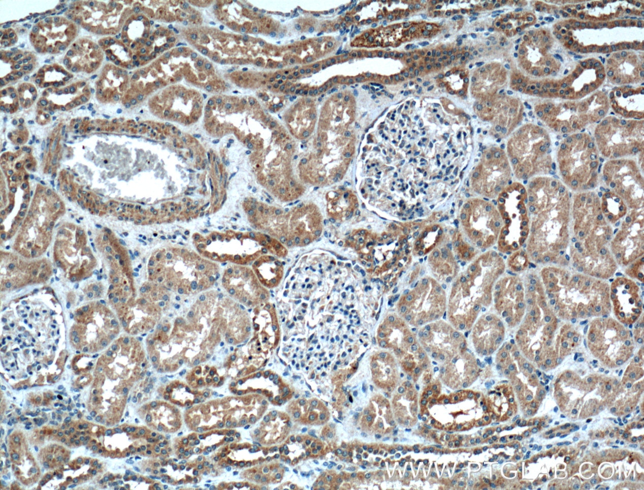 IHC staining of human kidney using 27189-1-AP