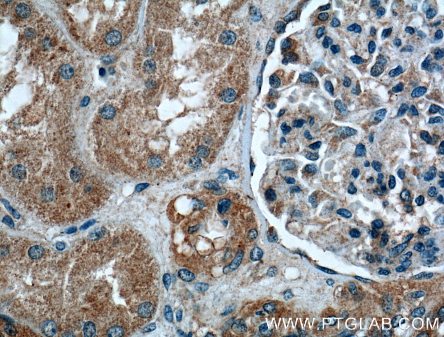 Immunohistochemistry (IHC) staining of human kidney tissue using Integrin Alpha 6 Polyclonal antibody (27189-1-AP)