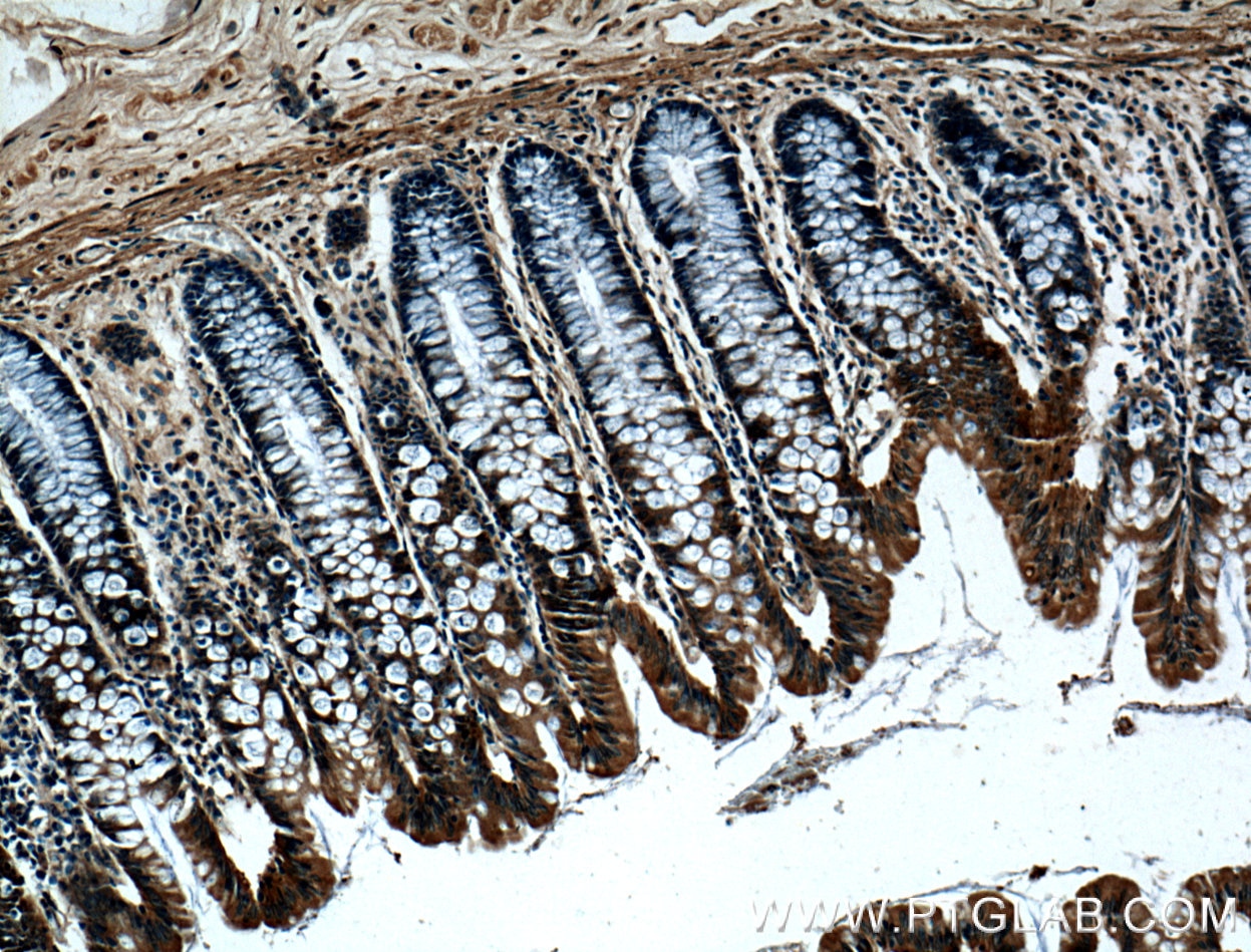 IHC staining of human colon using 27189-1-AP