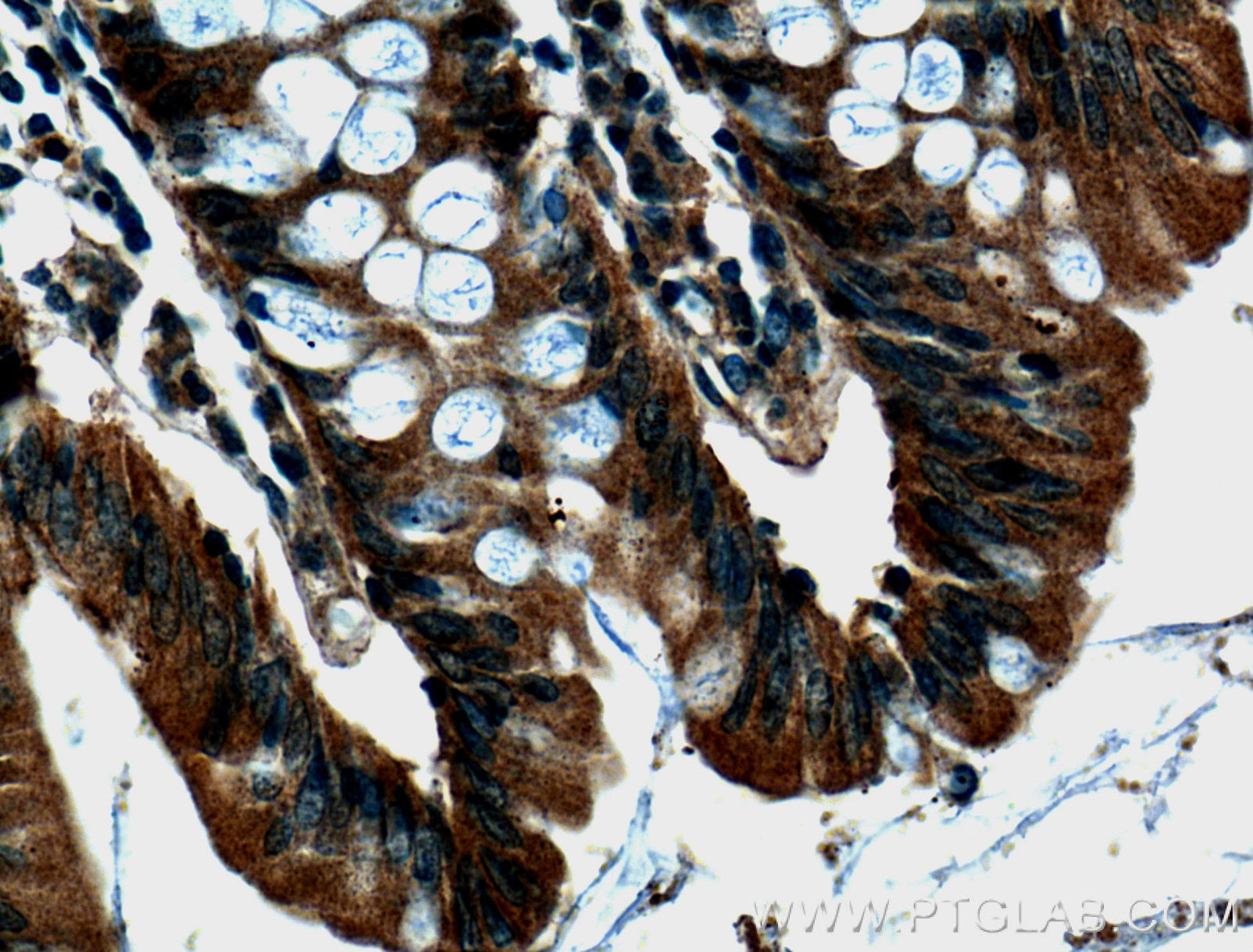 Immunohistochemistry (IHC) staining of human colon tissue using Integrin Alpha 6 Polyclonal antibody (27189-1-AP)
