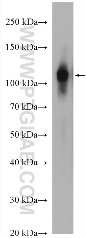 Western Blot (WB) analysis of mouse skin tissue using Integrin Alpha 6 Polyclonal antibody (27189-1-AP)