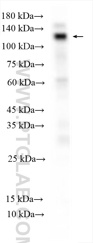 WB analysis of rat lung using 27189-1-AP