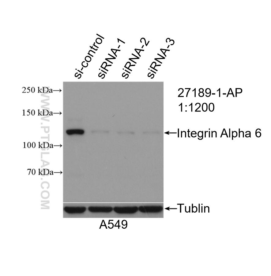 Western Blot (WB) analysis of A549 cells using Integrin Alpha 6 Polyclonal antibody (27189-1-AP)
