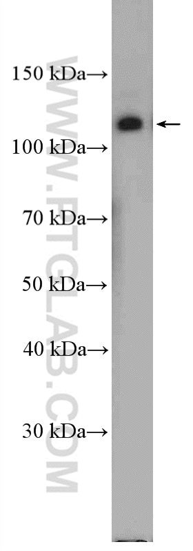 Western Blot (WB) analysis of A431 cells using Integrin Alpha 6 Polyclonal antibody (27189-1-AP)