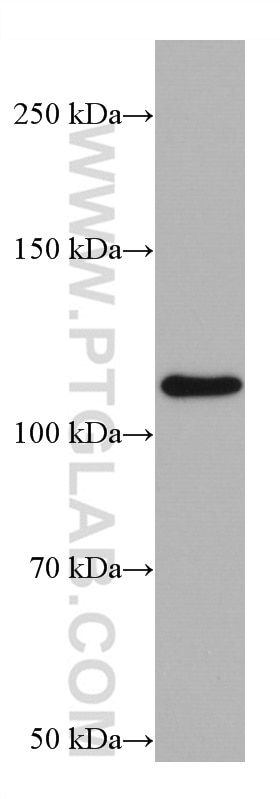 Western Blot (WB) analysis of A431 cells using Integrin Alpha 6 Monoclonal antibody (66906-1-Ig)
