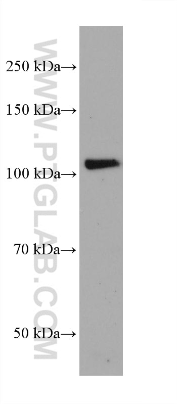 Western Blot (WB) analysis of JAR cells using Integrin Alpha 6 Monoclonal antibody (66906-1-Ig)