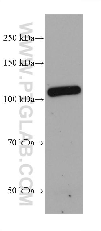 WB analysis of human placenta using 66906-1-Ig