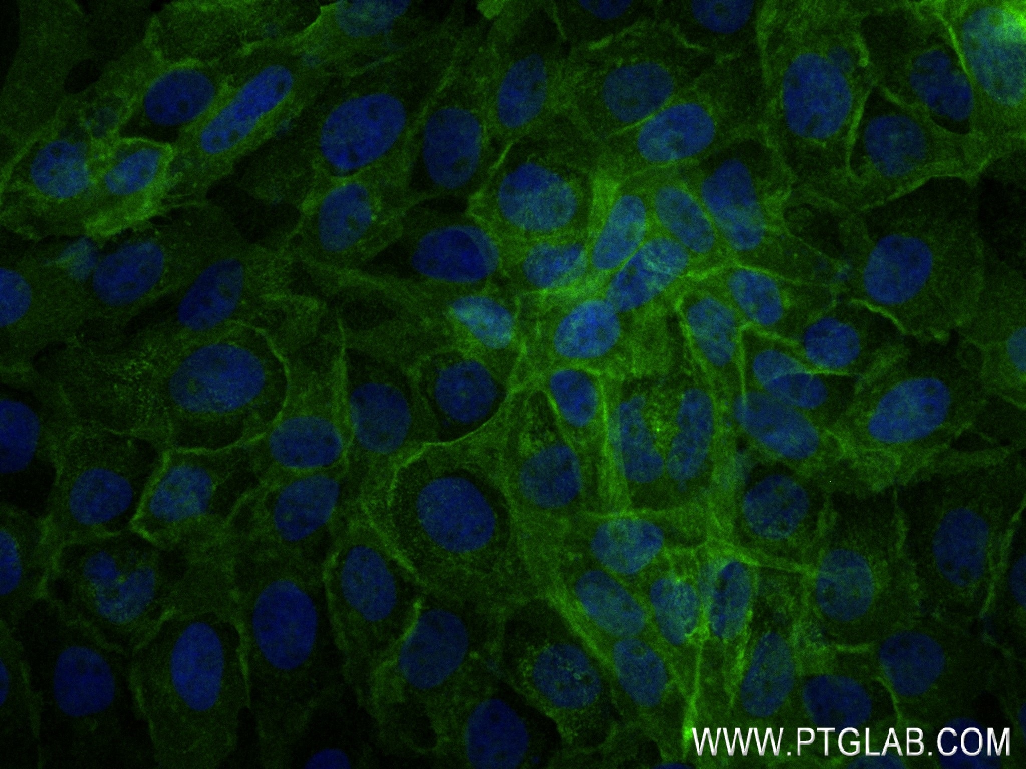 Immunofluorescence (IF) / fluorescent staining of A431 cells using Integrin alpha 6 Recombinant antibody (84463-3-RR)