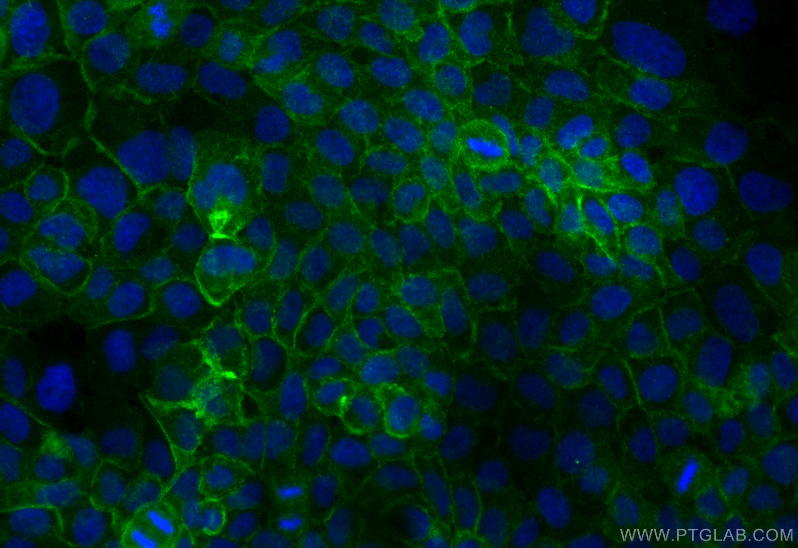 Immunofluorescence (IF) / fluorescent staining of A431 cells using CoraLite® Plus 488-conjugated Integrin alpha 6 Rec (CL488-84463-2)