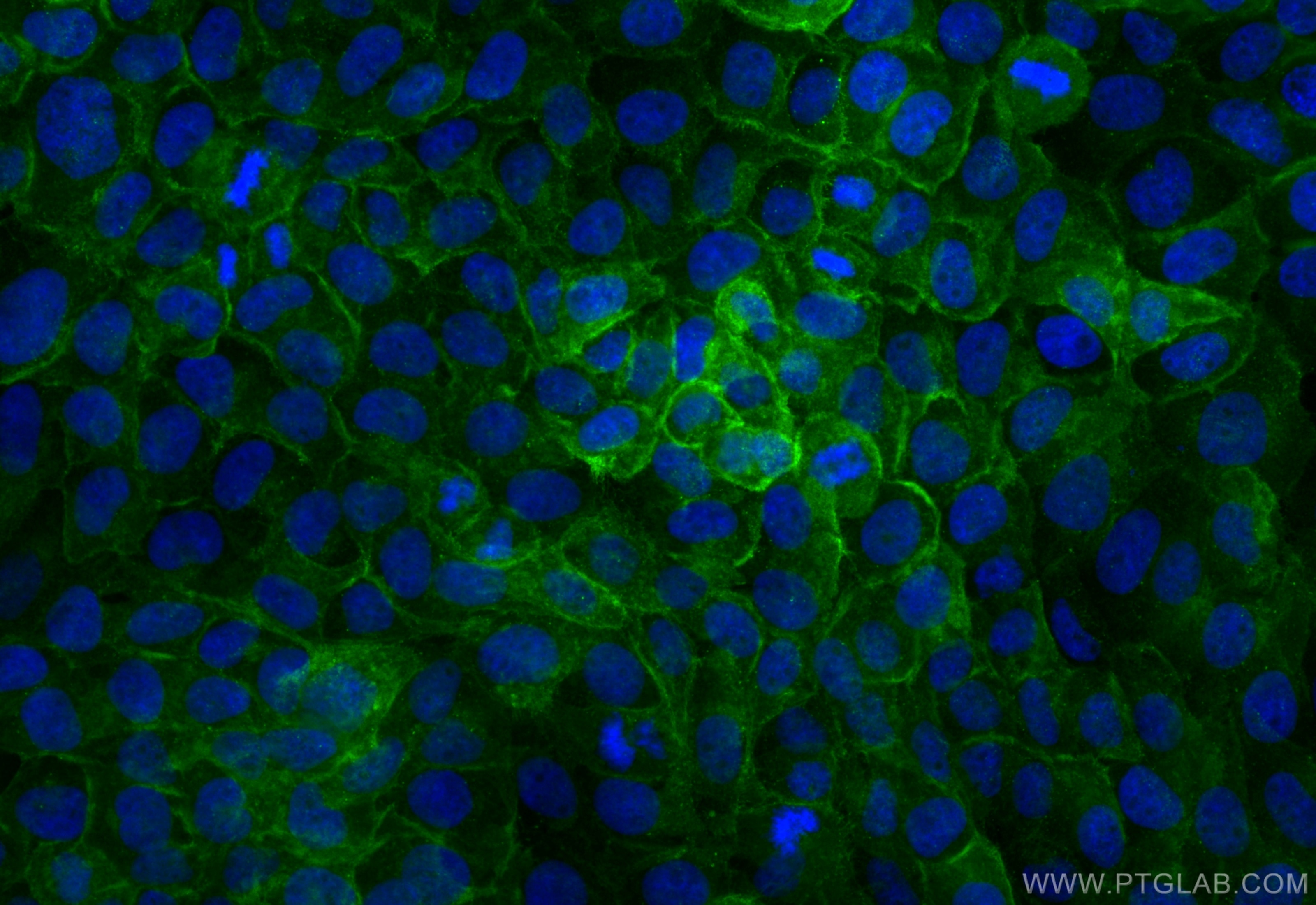 Immunofluorescence (IF) / fluorescent staining of A431 cells using CoraLite® Plus 488-conjugated Integrin alpha 6 Rec (CL488-84463-3)
