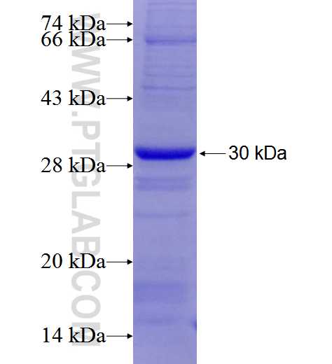 Integrin alpha-6 fusion protein Ag25866 SDS-PAGE