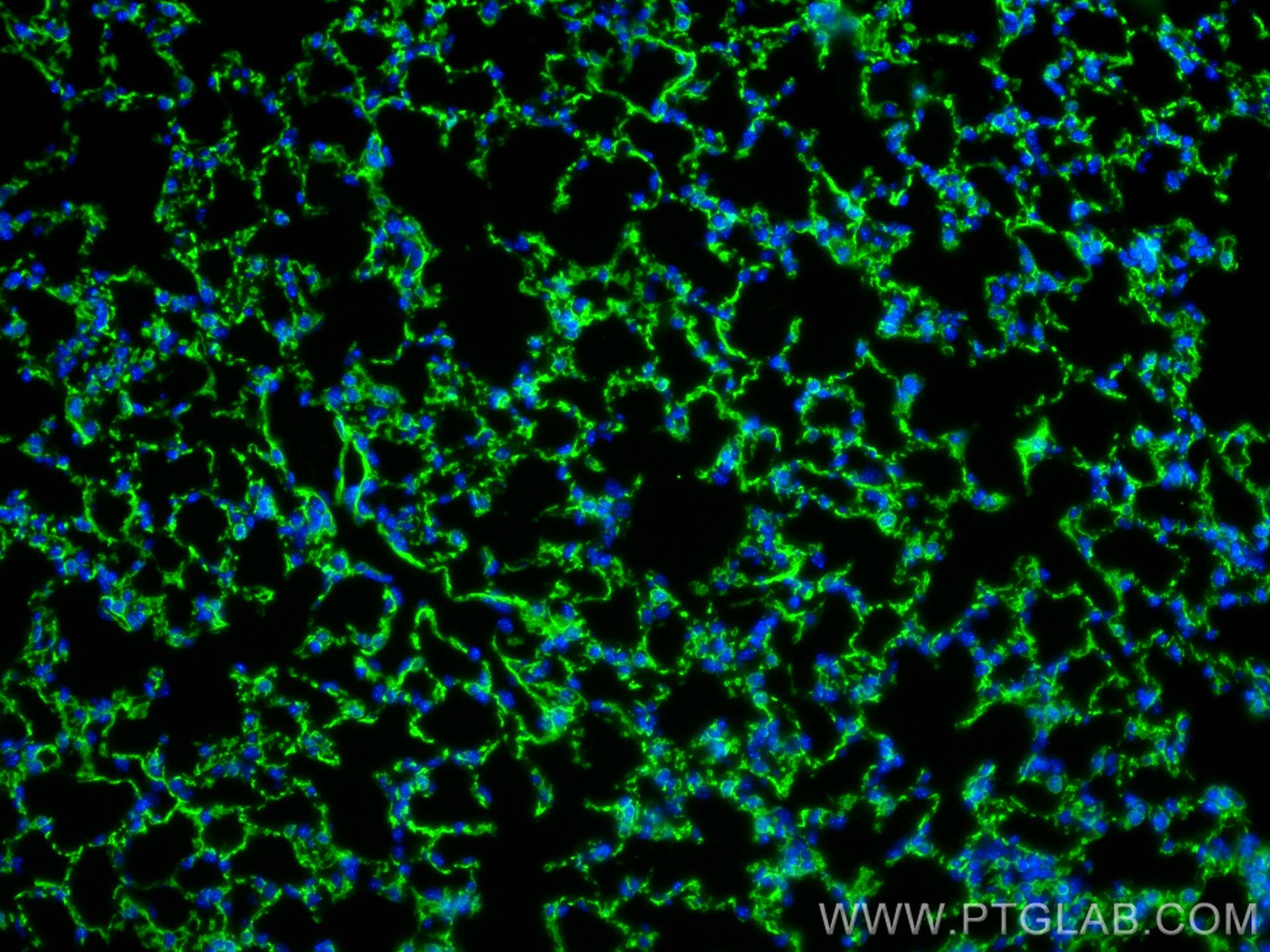 Immunofluorescence (IF) / fluorescent staining of mouse lung tissue using Integrin alpha-8 Polyclonal antibody (30714-1-AP)