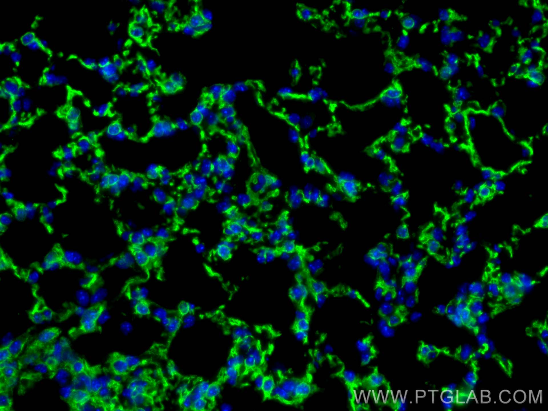 Immunofluorescence (IF) / fluorescent staining of mouse lung tissue using Integrin alpha-8 Polyclonal antibody (30714-1-AP)